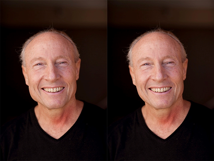 Reducing the size of a jaw with Photoshop